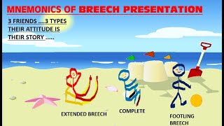 BREECH PRESENTATION MNEMONICS  STORY OF THREE FRIENDS ON BEACH  EASY LEARNING  MALPRSENTATION [upl. by Carrick]