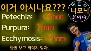 니모닉 Petechia purpura Ecchymosis [upl. by Quintie489]