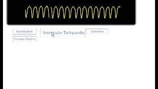 ACLS ECG Rhythm Review  YouTube [upl. by Lsil865]