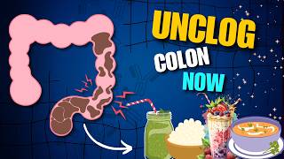 10 Drinks To Unclog Your Colon  Healthy Drinks That Make You Poop Immediately  Constipation [upl. by Marigolde]