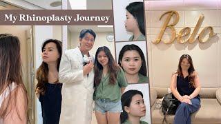 My Rhinoplasty Journey Part 1 Made by Doctor Nato of Belo Medical Group  Philippines [upl. by Gereron79]