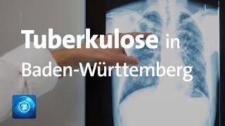 Tuberkulose Schüler und Lehrer in BadenWürttemberg erkrankt [upl. by Aynuat]