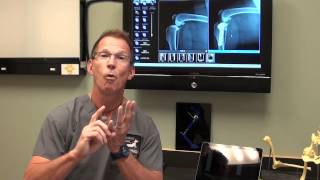 Canine ACL Tears and TPLO Surgery discussed by Dr Bauer DVM DACVS [upl. by Letnohs]