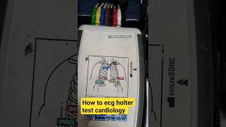 how to ecg holter test 24 house bsc cardiologist  viralvideo viral like heartcentercard [upl. by Layne688]