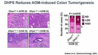 Hypusine and electrophilic stress in colitis and colon carcinogenesis [upl. by Nylidnam]