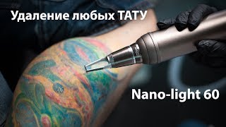 Nano Light 60  неодимовый короткоимпульсный лазер САМОГО последнего поколения [upl. by Oilime]