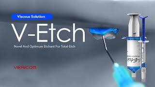 VEtch etch Total etch [upl. by Riti778]