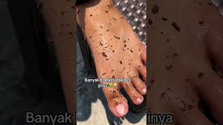 Deep Cleansing Remove Dust and Dead Skin ameenbeautytips [upl. by Atinomar]