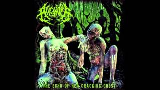 Acranius  The Echo Of Her Cracking Chest 2011 FullAlbum [upl. by Goldenberg]