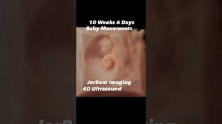 4D Ultrasound jerbearimaging 10weeks baby pregnant 4dultrasound hdlive sono [upl. by Aihsemat]