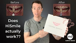 HiSmile Review By A Dentist Dr Grant McGrath [upl. by Brenna]