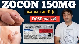 zocon 150  zocon 150 is used for in hindi  zocon 150 tablet  zocon 150 fluconazole [upl. by Notnek]