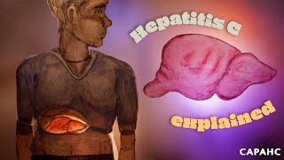 Hepatitis C explained [upl. by Rasla]