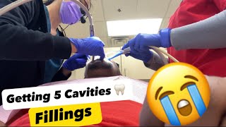 Escape Dental Nightmares My Experience with 5 Cavities Fillings 😱 dentist toothcare [upl. by Yklam]