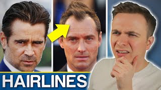 Widows Peak VS Receding Hairline  Should You Be Worried [upl. by Orthman]