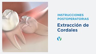 Instrucciones Postoperatorias Extracción de Cordales  Greater Ventura Oral amp Facial Surgery [upl. by Nylkcaj680]