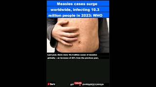 Measles cases surge worldwide infecting 103 million people in 2023 WHOShorts [upl. by Nerual]