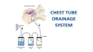 Managing CHEST TUBE DRAINAGE SYSTEM [upl. by Aihtibat]