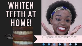 HOME Teeth Whitening with Opalescence Go  REVIEW  South African Beauty Blogger Laurina Machite [upl. by Gomar]