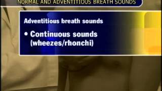 Normal amp Adventitous Breath Sounds [upl. by Critta526]