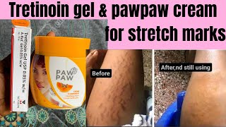 This 2 products clear stretch marks in 7days how to treat stretch marks in 7daystretinoin all [upl. by Esinahs657]