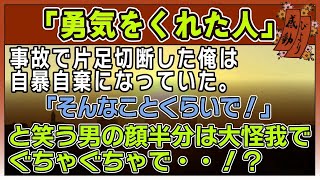 【感動する話】勇気をくれた人【泣ける話】 〜事故で片足切断した俺は自暴自棄になっていた。「そんなことくらいで！」と笑う男の顔半分は大怪我でぐち [upl. by Vescuso]