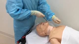 LMA Fastrach removal after tracheal intubation [upl. by Egidio]