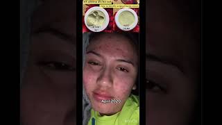 Goree cream  Goree whitening cream  pigmentation cream  dark spots remove cream shortvideo [upl. by Kcirb]