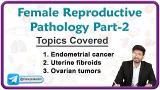 Female Reproductive Pathology Part  2  Endometrial cancer Uterine fibroids and Ovarian tumors [upl. by Yseulte]