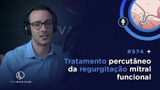 Click Valvar 574  Tratamento percutâneo da regurgitação mitral funcional [upl. by Tehcac]