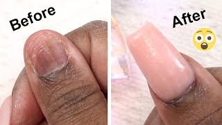 MY Real Nail Came OFF  Heres How I Fixed It [upl. by Ylloj]