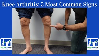 Knee Arthritis 5 Most Common Signs You Have It [upl. by Neehsuan]