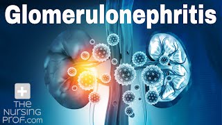 Renal Emergencies Glomerulonephritis [upl. by Aisined41]