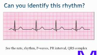 ECGEKG Electrocardiogram interpretation [upl. by Nodnarbal507]