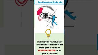 lacrimal apparatus anatomy ophthalmology [upl. by Sato]