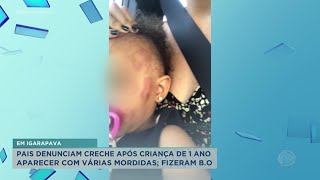 Bebê de 1 ano leva mordidas no corpo dentro de creche particular em Igarapava [upl. by Aikyn]