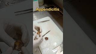 proforated appendix grossing அப்பெண்டிஸ்  biopsy pathology tissueprocessing tissuepreparation [upl. by Sanburn]