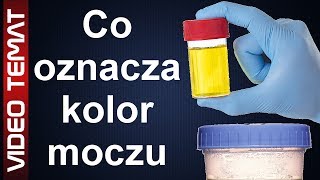 Co oznacza kolor moczu [upl. by Naldo348]