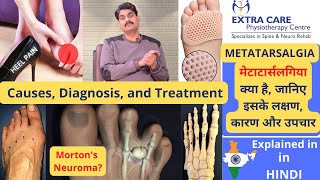 Metatarsalgia  Causes Diagnosis and Treatment  पंजों में दर्द  Mortons Neuroma  in HINDI [upl. by Ail]