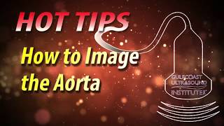 How to Image the Aorta Using Ultrasound [upl. by Hpsoj858]