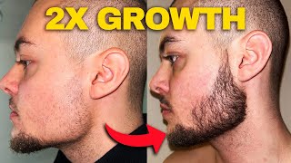 Minoxidil Beard Growth  How To Double Your Minoxidil Beard Growth Results [upl. by Priebe]