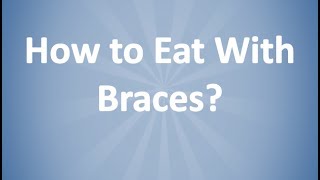 How to Eat With Braces  Orthodontist  Winter Springs FL [upl. by Adyam]