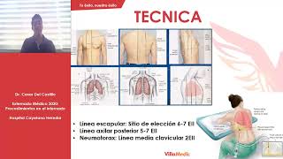 CLASE Nº8  Toracocentesis [upl. by Maren]