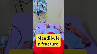 Mandibular fracture  mandular fracture surgery  mandibular surgery care [upl. by Wera286]