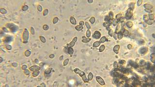 Bacteria and yeast movement microscope video [upl. by Nayk]