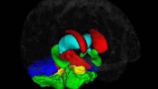 Brain Morphometry  Brain Image Analysis [upl. by Reppiks]