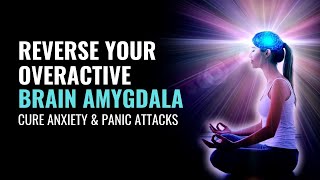 Reverse Your Overactive Brain Amygdala  Lessen Fear Response in Body  Cure Anxiety amp Panic Attacks [upl. by Hnah]