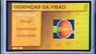 Doenças da Visão  parte1 [upl. by Oirevas]