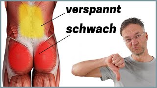 Die häufigste Ursache für Rückenschmerzen Anatomie erklärt [upl. by Bottali785]