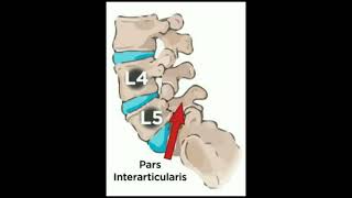 Pars interarticularis doctor short shortsfeed [upl. by Nairrot652]